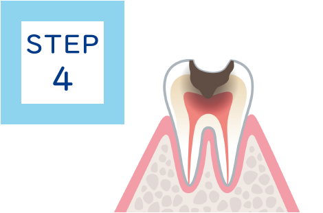 STEP4